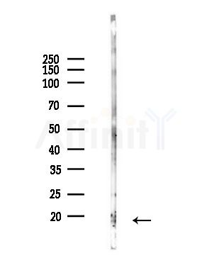 RPS11 Antibody - Western blot analysis of lysates from Hela cells(UV,30min treatment), using RPS11 Antibody at 1/1000 dilution.