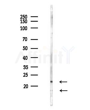 RPS11 Antibody - Western blot analysis of lysates from COLO205 cells(UV,30min treatment), using RPS11 Antibody at 1/1000 dilution.