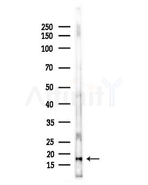 RPS18 Antibody - Western blot analysis of lysates from Hela cells(heat-shock,45min treatment), using RPS18 Antibody at 1/1000 dilution.