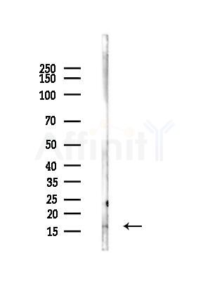RPS23 Antibody - Western blot analysis of lysates from EC304 cells(heat-shock,45min treatment), using RPS23 Antibody at 1/1000 dilution.