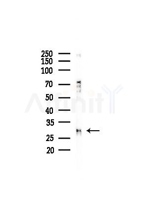 RPS4X Antibody - Western blot analysis of lysates from LoVo cells(heat-shock,45min treatment), using RPS4X Antibody at 1/1000 dilution.