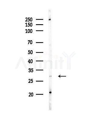 RPS4Y1 Antibody - Western blot analysis of lysates from Hela cells(starvation,24h treatment), using RPS4Y1 Antibody at 1/1000 dilution.
