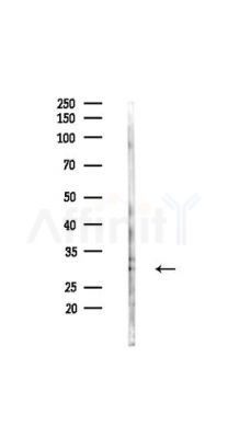 RPS8 Antibody - Western blot analysis of lysates from HUVEC cells(UV,30min treatment), using RPS8 Antibody at 1/1000 dilution.