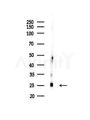 RPL10A Antibody - Western blot analysis of lysates from Hela cells, using RPL10A Antibody at 1/1000 dilution.