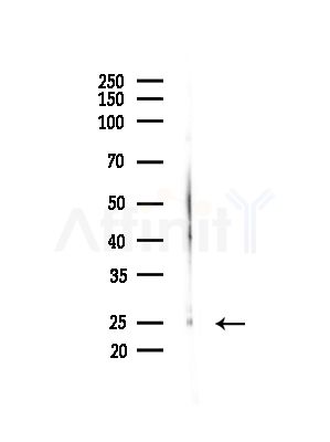 RPL10A Antibody - Western blot analysis of lysates from Mouse brain, using RPL10A Antibody at 1/1000 dilution.