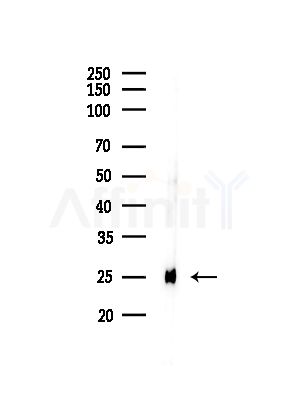 RPL10A Antibody - Western blot analysis of lysates from COLO205 cells, using RPL10A Antibody at 1/1000 dilution.