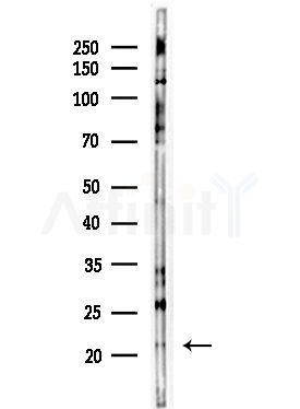 RPL11 Antibody - Western blot analysis of lysates from Hela cells(starvation,24h treatment), using RPL11 Antibody at 1/1000 dilution.