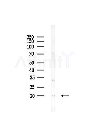 RPL15 Antibody - Western blot analysis of lysates from Rat lung, using RPL15 Antibody at 1/1000 dilution.