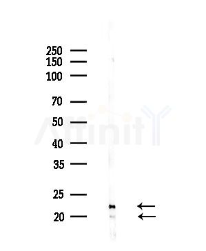 RPL17 Antibody - Western blot analysis of lysates from PC12 cells(LPS,4h treatment), using RPL17 Antibody at 1/1000 dilution.