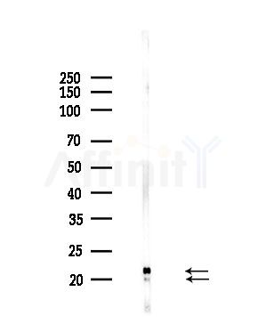 RPL17 Antibody - Western blot analysis of lysates from Hela cells(starvation,24h treatment), using RPL17 Antibody at 1/1000 dilution.
