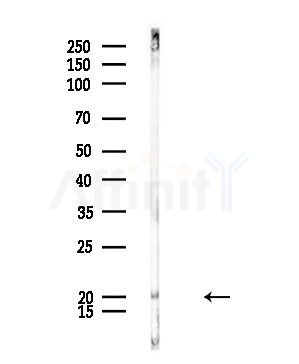 RPL17 Antibody - Western blot analysis of lysates from Rat lung, using RPL17 Antibody at 1/1000 dilution.