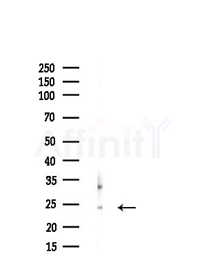 RPL18 Antibody - Western blot analysis of lysates from HUVEC cells(starvation,24h treatment), using RPL18 Antibody at 1/1000 dilution.