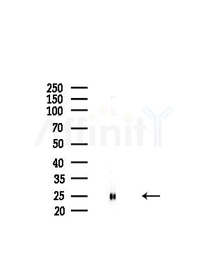 RPL19 Antibody - Western blot analysis of lysates from A375 cells(starvation,24h treatment), using RPL19 Antibody at 1/1000 dilution.