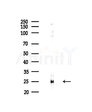 RPL19 Antibody - Western blot analysis of lysates from HepG2 cells(LPS,4h treatment), using RPL19 Antibody at 1/1000 dilution.