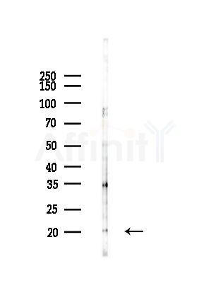 RPL26L Antibody - Western blot analysis of lysates from COLO205 cells(heat-shock,45min treatment), using RPL26L Antibody at 1/1000 dilution.