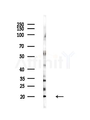 RPL26L Antibody - Western blot analysis of lysates from Hela cells(LPS, 4h treatment), using RPL26L Antibody at 1/1000 dilution.