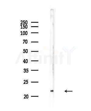 RPL27A Antibody - Western blot analysis of lysates from COLO205 cells, using RPL27A Antibody at 1/1000 dilution.