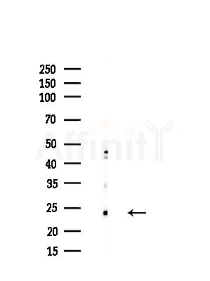 RPL28 Antibody - Western blot analysis of lysates from HUVEC cells(starvation,24h treatment), using RPL28 Antibody at 1/1000 dilution.