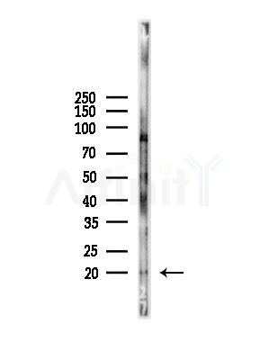 RPL35 Antibody - Western blot analysis of lysates from LoVo cells(heat-shock,45min treatment), using RPL35 Antibody at 1/1000 dilution.