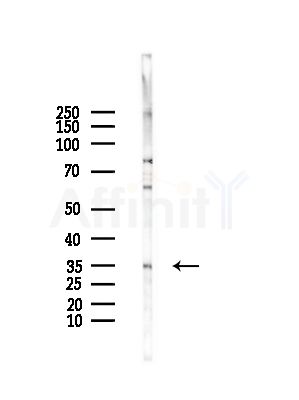 RPL5 Antibody - Western blot analysis of lysates from HepG2 cells(LPS,4h treatment), using RPL5 Antibody at 1/1000 dilution.