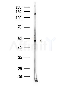 ABHD12 Antibody - Western blot analysis of lysates from MDA-MB-231 cells(heat-shock,45min treatment), using ABHD12 Antibody at 1/1000 dilution.