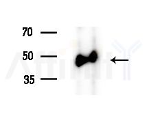 ABHD2 Antibody - Western blot analysis of extracts from HUVEC cells(starvation treatment), using ABHD2 Antibody at 1/1000 dilution.