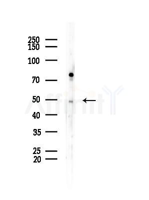 ABHD2 Antibody - Western blot analysis of lysates from HUVEC cells(starvation,24h treatment), using ABHD2 Antibody at 1/1000 dilution.