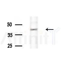 ABHD7 Antibody - Western blot analysis of extracts from Hela cells(heat-shock,45min treatment), using ABHD7 Antibody at 1/1000 dilution.
