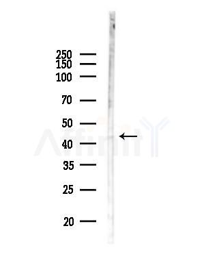 ABHD7 Antibody - Western blot analysis of lysates from Hela cells(heat-shock,45min treatment), using ABHD7 Antibody at 1/1000 dilution.
