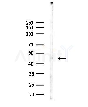 ABHD8 Antibody - Western blot analysis of lysates from MDA-MB-231 cells, using ABHD8 Antibody at 1/1000 dilution.