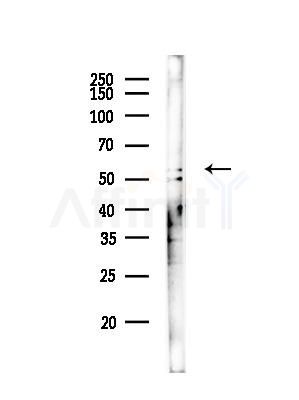 CHRNB1 Antibody - Western blot analysis of lysates from Mouse brain, using CHRNB1 Antibody at 1/1000 dilution.
