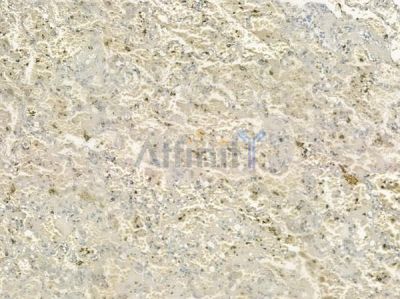 ACSS1 Antibody - DF3727 at 1/100 staining human normal lung tissue by IHC-P.