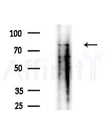 ACSA Antibody - Western blot analysis of lysates from Mouse liver, using ACSA Antibody at 1/1000 dilution.
