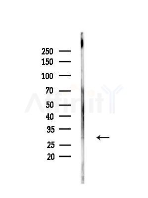 ANP32B Antibody - Western blot analysis of lysates from RAW264.