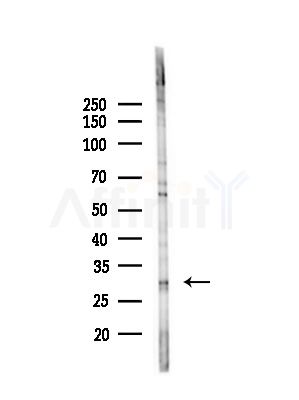 ACBD6 Antibody - Western blot analysis of lysates from HepG2 cells(UV,30min treatment), using ACBD6 Antibody at 1/1000 dilution.
