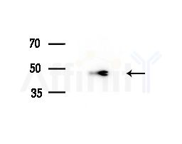 ACOT4 Antibody - Western blot analysis of lysates from HUVEC cells(starvation treatment), using ACOT4 Antibody at 1/1000 dilution.