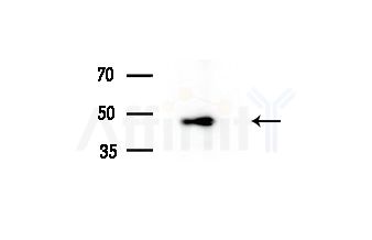 ACOT4 Antibody - Western blot analysis of lysates from Rat brain, using ACOT4 Antibody at 1/1000 dilution.