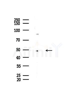 ACOT4 Antibody - Western blot analysis of lysates from HUVEC cells(starvation,24h treatment), using ACOT4 Antibody at 1/1000 dilution.