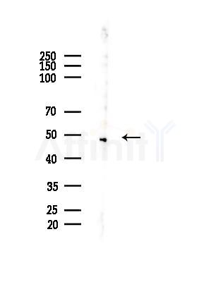 ACOT4 Antibody - Western blot analysis of lysates from Rat brain, using ACOT4 Antibody at 1/1000 dilution.
