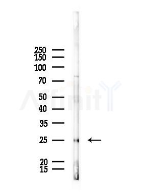 LYPLA1 Antibody - Western blot analysis of lysates from Rat liver, using LYPLA1 Antibody at 1/1000 dilution.