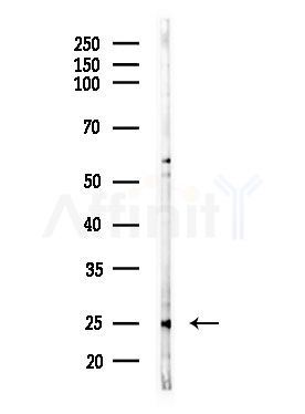 LYPLA1 Antibody - Western blot analysis of lysates from MDA-MB-231 cells(heat-shock,45min treatment), using LYPLA1 Antibody at 1/1000 dilution.