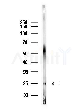 LYPLA1 Antibody - Western blot analysis of lysates from Mouse lung, using LYPLA1 Antibody at 1/1000 dilution.