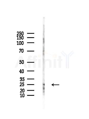 ARF4 Antibody - Western blot analysis of lysates from HepG2 cells(LPS,4h treatment), using ARF4 Antibody at 1/1000 dilution.