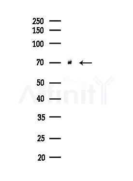 ARFGAP3 Antibody - Western blot analysis of lysates from Hela cells(starvation,24h treatment), using ARFGAP3 Antibody at 1/1000 dilution.