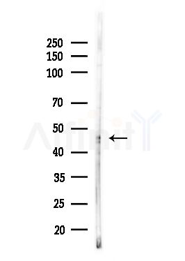 AGXT2L2 Antibody - Western blot analysis of lysates from HUVEC cells(UV,30min treatment), using AGXT2L2 Antibody at 1/1000 dilution.