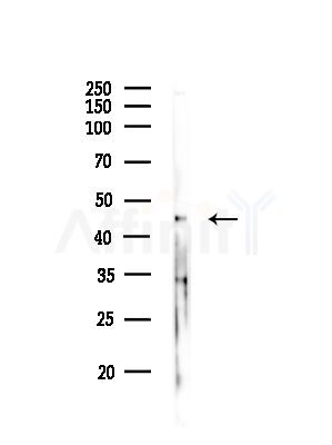 AARSD1 Antibody - Western blot analysis of lysates from COLO205 cells(heat-shock,45min treatment), using AARSD1 Antibody at 1/1000 dilution.