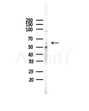 ALDH1B1 Antibody - Western blot analysis of lysates from COLO205 cells(heat-shock,45min treatment), using ALDH1B1 Antibody at 1/1000 dilution.