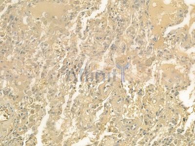 AOX1 Antibody - DF3756 at 1/100 staining human normal lung tissue by IHC-P.