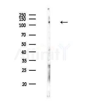 AOX1 Antibody - Western blot analysis of lysates from HUVEC cells, using AOX1 Antibody at 1/1000 dilution.