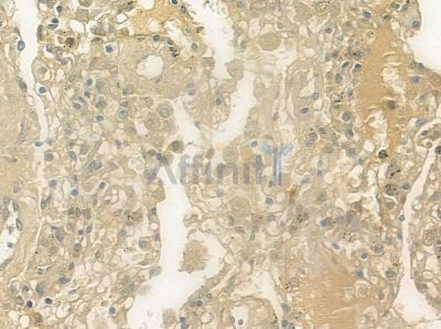 PHCA Antibody - DF3761 at 1/100 staining human normal lung tissue by IHC-P.